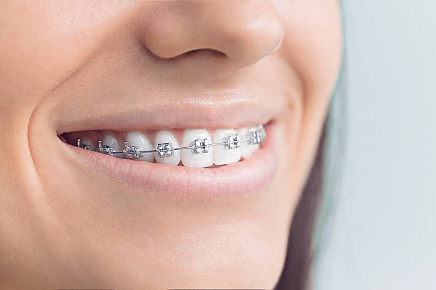 Best Traditional Braces  in Blandon, PA